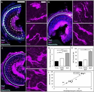 Age-Related Hearing Loss Is Accompanied by Chronic Inflammation in the Cochlea and the Cochlear Nucleus